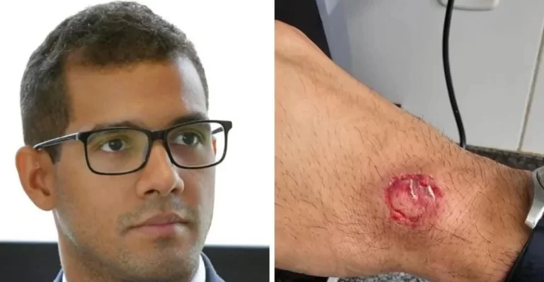 Homem invade fórum e morde juiz em Bom Jardim; saiba detalhes